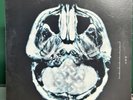 Breaking Benjamin - Dear Agony - Vinyl LP Album RARE (500 Print Run) - OOP