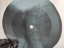 BEATLES ALL YOU NEED IS LOVE X-Ray USSR Record Roentgen Bones Ribs Music Vinyl