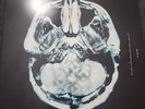 Breaking Benjamin - Dear Agony - Vinyl LP Album RARE (500 Print Run) - OOP