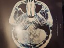 Breaking Benjamin - Dear Agony - Vinyl LP Album RARE (500 Print Run) - OOP