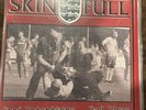 SKINFUL BRITISH DOUBLE LP OI BUSINESS LAST RESORT