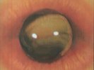 TOM ZE - Todos Os Olhos (reissue) (Special Edition) - Vinyl (LP)