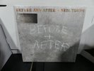 Neil Young – Before And After LP On Limited Edition Clear Vinyl