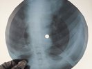 BOB DYLAN VISIONS OF JOHANNA X-Ray USSR Record Roentgen Bone Ribs Music Vinyl