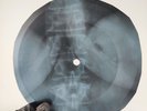 PINK FAT OLD SUN  X-Ray USSR Record Roentgen Bone Ribs Music Vinyl