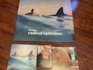 Dua Lipa Radical Optimism Bundle Curaçao Blue Vinyl CD Cassette Signed Insert