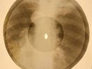 X-RAY USSR ROENTGEN BONES RECORD ORIGINAL OLD RIBS 585