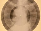 78 rpm X-RAY USSR ROENTGEN BONES RECORD ORIGINAL OLD RIBS 621