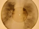 X-RAY USSR ROENTGEN BONES RECORD ORIGINAL OLD RIBS 661