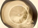 11pcs X-RAY ROENTGENUSSR BONES RECORD703 753 724 720 722 689 688 750 714 687 684