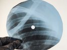 NINA SIMONE I PUT A SPELL ON  X-Ray USSR Record Roentgen Ribs Bone Music Vinyl
