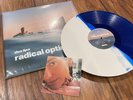 Dua Lipa - Radical Optimism (Signed Blue White Vinyl LP) Rare New