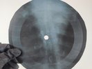 DAVID BOWIE LET ME SLEEP BESIDE X-Ray USSR Record Roentgen Ribs Bone Music Vinyl