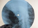 PINK FLOYD FAT OLD SUN X-Ray USSR Record Roentgen Bone Ribs Music Vinyl