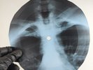 VELVET UNDERGROUND SWEET JANE X-Ray USSR Record Roentgen Bone Rib Music Vinyl