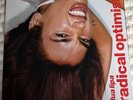 Radical Optimism Dua Lipa (2024) Alt Cover Clear Vinyl