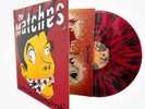 The Matches - E. Von Dahl Killed the Locals - 2024 20th Anniversary LE Vinyl LP