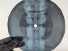 PINK FLOYD FAT OLD SUN X-Ray USSR Record Roentgen Bone Ribs Music Vinyl