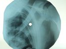BEATLES COME TOGETHER X-Ray USSR Record Roentgen Bones Ribs Music Vinyl