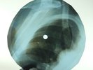 NINA SIMONE LOVE YOU PORGY X-Ray USSR Record Roentgen Bones Ribs Music Vinyl