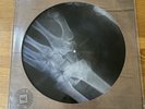 Kasabian - The Alchemists Euphoria - Blood Records X-Ray Picture Disc Vinyl - NM
