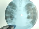 BEATLES TICKET TO RIDE X-Ray USSR Record Roentgen Bone Ribs Music Vinyl