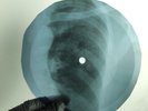 BEATLES I AM A WALRUS X-Ray USSR Record Roentgen Bone Ribs Music Vinyl