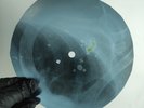 DAVID BOWIE LIFE ON MARS X-Ray USSR Record Roentgen Bone Ribs Music Vinyl