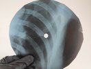 BEACH BOYS IN MY ROOM X-Ray USSR Record Roentgen Bone Ribs Music Vinyl