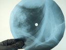 NINA SIMONE TURN TURN X-Ray USSR Record Roentgen Bone Ribs Music Vinyl