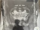 Travis Scott Utopia 2 Disk Vinyl LP Cover 5 New and Factory Sealed