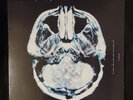 Dear Agony [LP] Breaking Benjamin 2009 Rock Vinyl Rare Limited print run 500 VG+