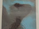 PINK FLOYD - MEDDLE - LP VINYL 12” SHVL 796 1971