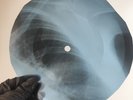 FITZGERALD&ARMSTRONG NEARNESS OFX-Ray USSR Record Roentgen Bone Ribs Music Vinyl