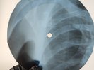 J CASH RING OF FIRE X-Ray USSR Record Roentgen Bone Ribs Music Vinyl