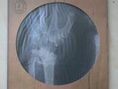 KASABIAN-The Alchemists Euphoria -Ltd Numbered X-RAY PICTURE DISC Vinyl LP Ex/Ex