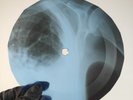 DOORS HELLO I LOVE YOU X-Ray USSR Record Roentgen Bone Ribs Music Vinyl