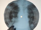 DOORS MOONLIGHT DRIVE X-Ray USSR Record Roentgen Bone Ribs Music Vinyl