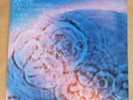 (#6 of 9) Spotless Gatefold LP (1971) PINK FLOYD--Meddle