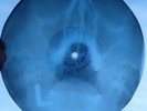 BLACK SABBATH -EVIL WOMAN - USSR GEORGIAN X-RAY BONES RECORD LISTEN