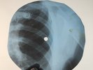 NINA SIMONE GIN HOUSE BLUES X-Ray USSR Record Roentgen Bone Ribs Music Vinyl