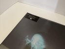 ETERNAL SUNSHINE TOUR EXCLUSIVE LENTICULAR COVER 2LP - Not A Pre-Order