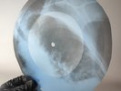 FITZGERALD&ARMSTRONG APRIL IN X-Ray USSR Record Roentgen Bone Ribs Music Vinyl