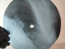 NINA SIMONE I PUT A SPELL ON YO X-Ray USSR Record Roentgen Bone Ribs Music Vinyl