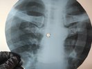 ARMSTRONG UNDER A BLANKET OF X-Ray USSR Record Roentgen Bone Ribs Music Vinyl
