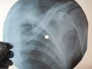 NINA SIMONE SATIN DOLL X-Ray USSR Record Roentgen Bone Ribs Music Vinyl