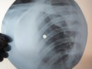 L. ARMSTRONG ONLY YOU X-Ray USSR Record Roentgen Bone Ribs Music Vinyl