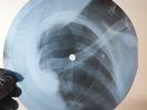 FITZGERALD ARMSTRONG I'LL WIND  X-Ray USSR Record Roentgen Bone Ribs Music Vinyl